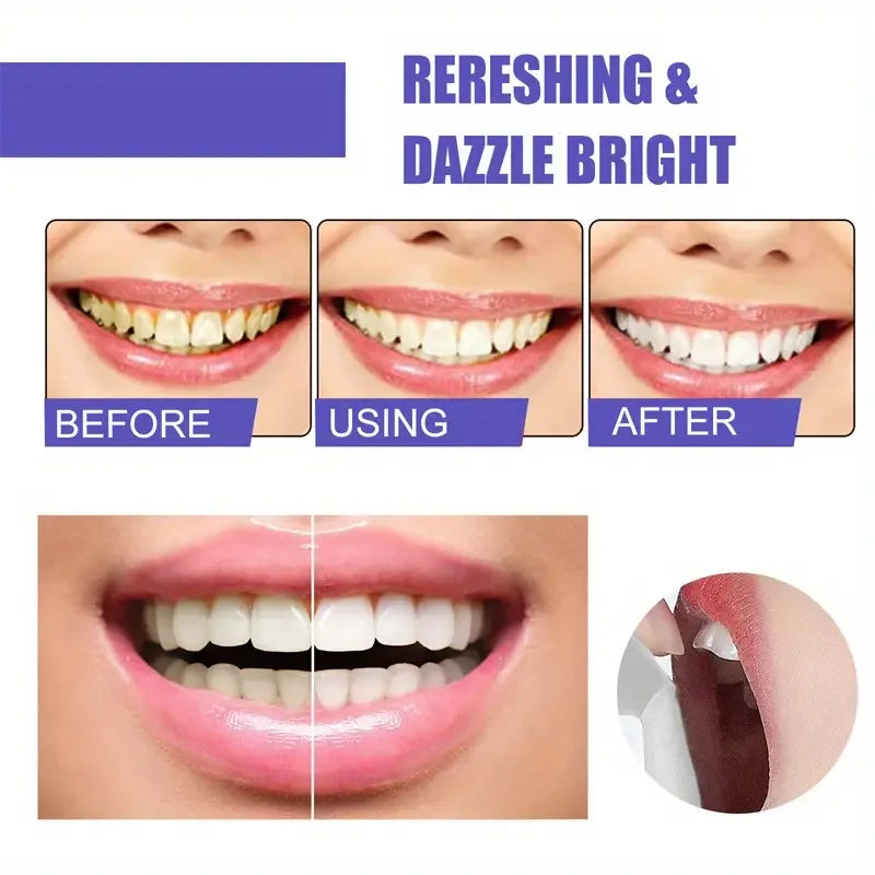 60ml Teeth Whitening Mousse: