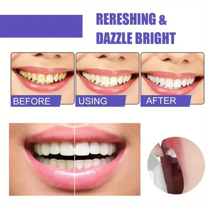 60ml Teeth Whitening Mousse: