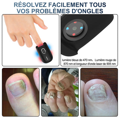 Appareil laser contre les champignons des ongles :