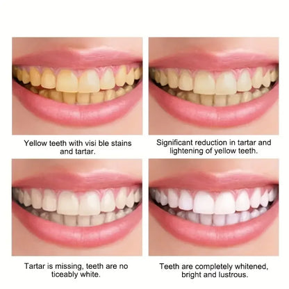 60ml Teeth Whitening Mousse: