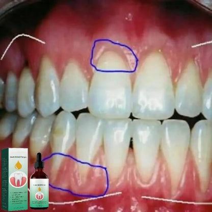 Gum Repair : Relief & Tartar Removal