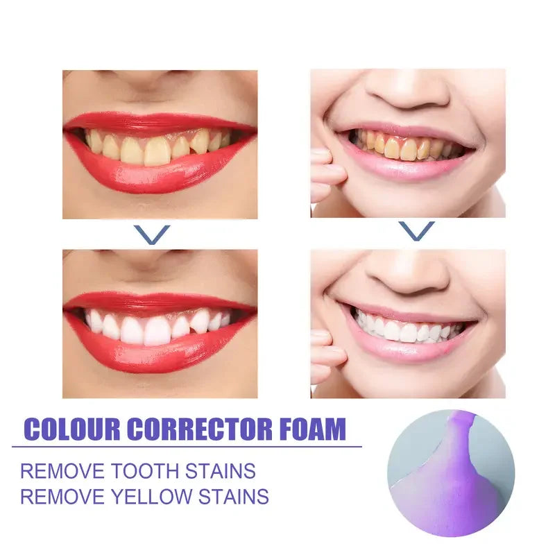 60ml Teeth Whitening Mousse: