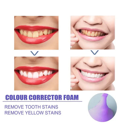 60ml Teeth Whitening Mousse: