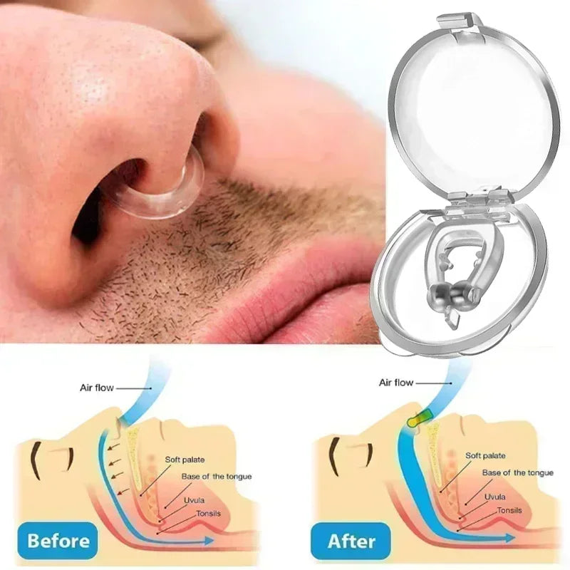 Snore Prevention Nose Clip: