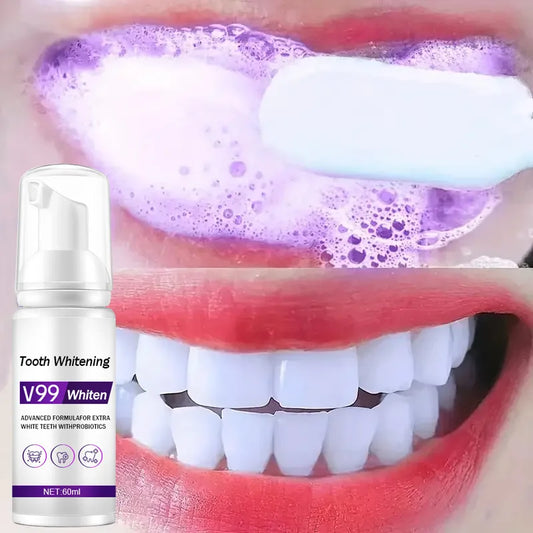 60ml Teeth Whitening Mousse: